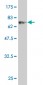 CLN3 Antibody (monoclonal) (M03)